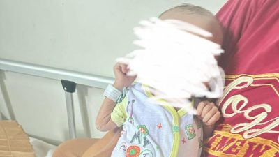 Butuh Bantuan, Bayi Berusia 8 Bulan Alami Stunting di RS Abunawas Kendari